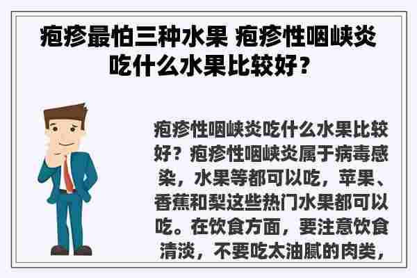 疱疹最怕三种水果 疱疹性咽峡炎吃什么水果比较好？